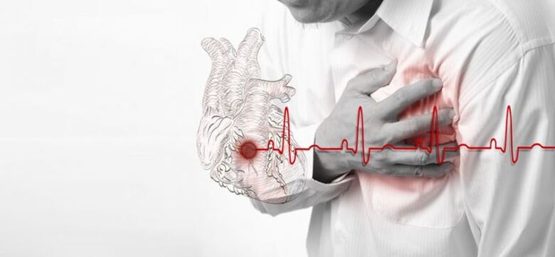 srčani udar kao uzrok boli ispod lijeve lopatice