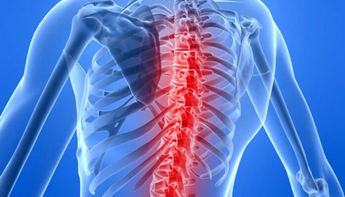 Patologije kralježnice najčešći su uzroci bolova u leđima u području lopatice