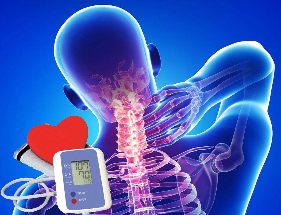 Skokovi krvnog tlaka s cervikalnom osteohondrozom