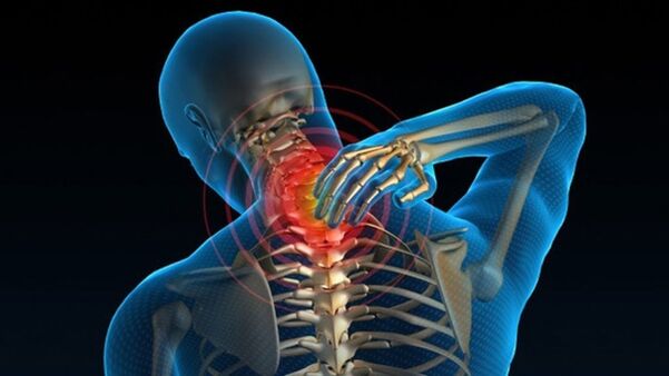 Bol pri okretanju vrata može ukazivati ​​na sindrom vertebralne cervikalne osteohondroze